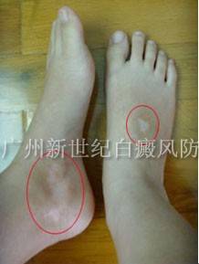 20120712170914.jpg