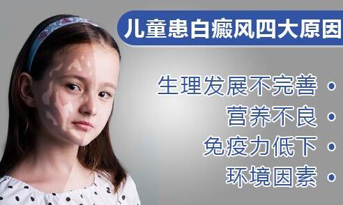 小孩得白癜风好治吗?儿童白癜风早期症状是什么样的?